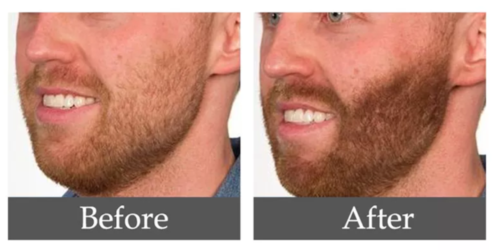 Spectacular Norse Beard Growth Serum Design Digital Art